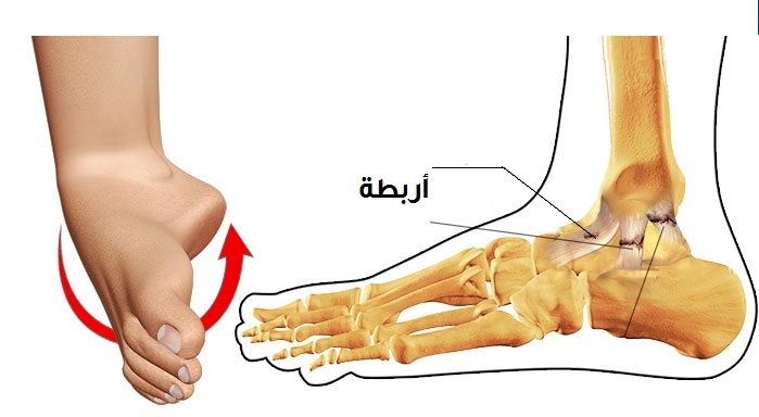 أعراض تمزق أربطة الكاحل